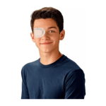 Parcheocular